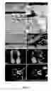 Fig. 02 - MODEL FOR MUSCULAR DYSTROPHY AND CARDIOMYOPATHY