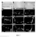 Fig. 04 - MODEL FOR MUSCULAR DYSTROPHY AND CARDIOMYOPATHY