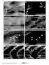 Fig. 06 - MODEL FOR MUSCULAR DYSTROPHY AND CARDIOMYOPATHY