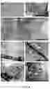 Fig. 07 - MODEL FOR MUSCULAR DYSTROPHY AND CARDIOMYOPATHY