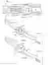 Fig. 04 - Bipolar cautery instrument