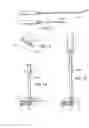 Fig. 07 - BONE SCREW RETAINING SYSTEM