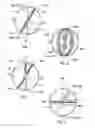 Fig. 02 - Artificial heart