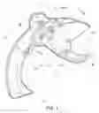 Fig. 02 - Plastic pipe cutting tool