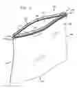 Fig. 02 - Reversible fastener for a resealable bag-type container