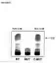 Fig. 05 - Targeting of triacylclycerol synthase gene for tuberculosis treatment