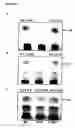 Fig. 07 - Targeting of triacylclycerol synthase gene for tuberculosis treatment