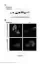 Fig. 08 - Goodpasture antigen binding protein and its detection