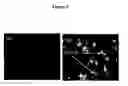 Fig. 11 -  Method for Identifying an Agent that Modulates Arginine Transport in a Chondrocyte