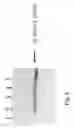 Fig. 08 - Genetically Altered Anti-body Producing Cell Lines With Improved Antibody Characteristics