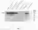 Fig. 03 - Biologically active recombinant human saposin C and PSAP