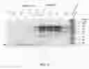 Fig. 04 - Biologically active recombinant human saposin C and PSAP