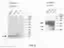 Fig. 07 - Biologically active recombinant human saposin C and PSAP