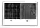 Fig. 01 - Adipose stromal stem cells for tissue and vascular modification