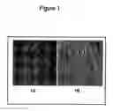 Fig. 02 - Adipose stromal stem cells for tissue and vascular modification