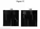 Fig. 16 - Adipose stromal stem cells for tissue and vascular modification