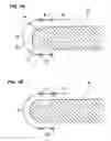 Fig. 02 - Substrate processing apparatus
