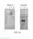 Fig. 12 - Recombinant toxin fragments