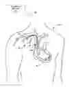 Fig. 01 - Virtual physician acute myocardial infarction detection system and method