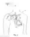 Fig. 02 - Virtual physician acute myocardial infarction detection system and method