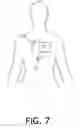 Fig. 08 - Virtual physician acute myocardial infarction detection system and method