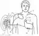 Fig. 01 - CPR assist device for measuring compression parameters during cardiopulmonary resuscitation