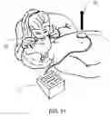 Fig. 22 - CPR assist device for measuring compression parameters during cardiopulmonary resuscitation