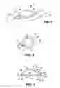 Fig. 02 - Ostomy appliance apparatus