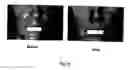 Fig. 05 - Method and process for producing youthful-appearing, small-pored, and smooth skin