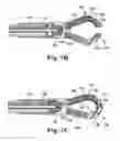 Fig. 07 - Surgical suture passers and methods