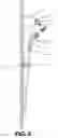 Fig. 07 - ADJUSTABLE ROD STRUCTURE