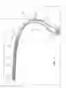 Fig. 02 - BODY PLY AND INSERT ASSEMBLY METHOD