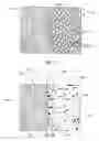 Fig. 02 - USE OF Ti AND Nb CEMENTED TiC IN PROSTHETIC JOINTS
