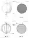 Fig. 20 - USE OF Ti AND Nb CEMENTED TiC IN PROSTHETIC JOINTS