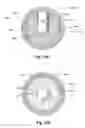 Fig. 28 - USE OF Ti AND Nb CEMENTED TiC IN PROSTHETIC JOINTS