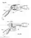 Fig. 59 - USE OF Ti AND Nb CEMENTED TiC IN PROSTHETIC JOINTS