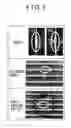 Fig. 04 - Method and system for inspection of tube width of heat exchanger