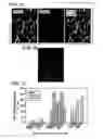 Fig. 02 - DIFFERENTIAL GENE EXPRESSION IN PHYSIOLOGICAL AND PATHOLOGICAL ANGIOGENESIS