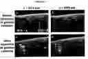 Fig. 06 - Molecular Specific Photoacoustic Imaging