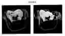 Fig. 08 - Molecular Specific Photoacoustic Imaging