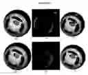 Fig. 12 - Molecular Specific Photoacoustic Imaging