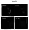 Fig. 13 - Molecular Specific Photoacoustic Imaging