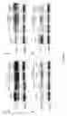 Fig. 28 - Methods and compositions for inhibiting diseases of the central nervous system