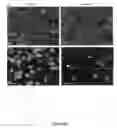 Fig. 63 - Methods and compositions for inhibiting diseases of the central nervous system