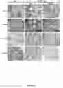 Fig. 99 - Methods and compositions for inhibiting diseases of the central nervous system