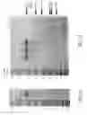 Fig. 04 - Compositions and methods comprising glycyl-tRNA synthetases having non-canonical biological activities