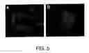 Fig. 10 - SYNERGISTIC EFFECT BETWEEN A CYANOGENIC SYSTEM AND ANOTHER OXIDATIVE INDUCING SYSTEM FOR TREATING TUMORS