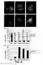 Fig. 11 - SYNERGISTIC EFFECT BETWEEN A CYANOGENIC SYSTEM AND ANOTHER OXIDATIVE INDUCING SYSTEM FOR TREATING TUMORS