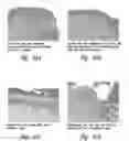 Fig. 26 - Compositions and methods for treating inflammation