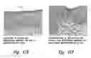 Fig. 27 - Compositions and methods for treating inflammation